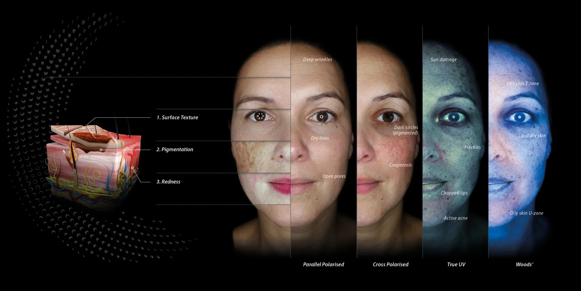 Skin Analysis Skin Analysis